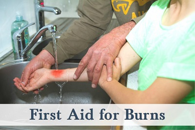 First Aid for Burns